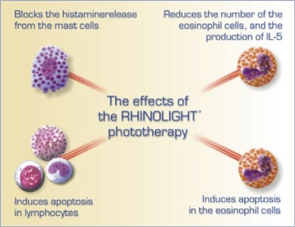 Rhinolight Mechanism