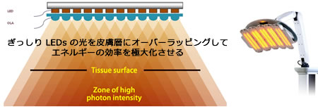 LED光治療：ヒーライト