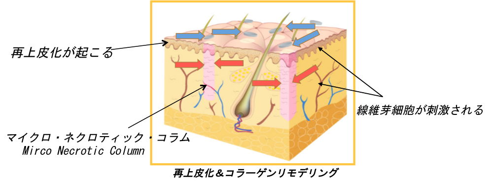 モザイク